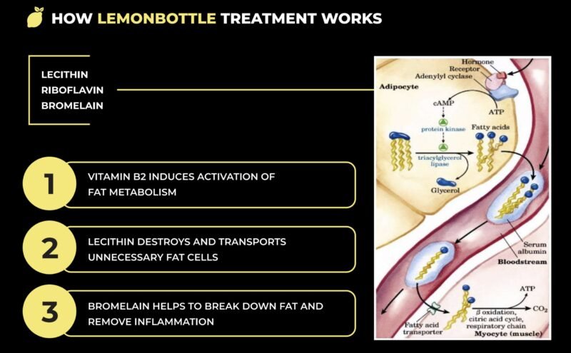 lemon bottle fat dissolving,lemon bottle fat dissolving near me,lemon bottle fat dissolver results,buy lemon bottle fat dissolving,lemon bottle fat dissolving usa,lemon bottle fat dissolving usa where to buy,Lemon Bottle Fat Dissolver